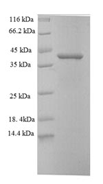 SDS-PAGE