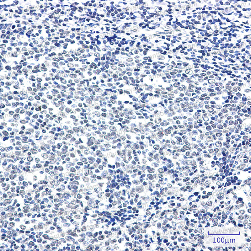 Валидация AntibodySystem RHD71301