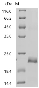 SDS-PAGE
