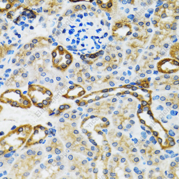 Иммуногистохимия, Caspase-3, ткань почки крысы
