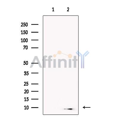 Валидация Affinity DF13746 - 9399