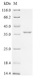 SDS-PAGE