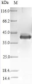 SDS-PAGE
