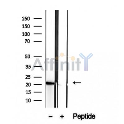 Валидация Affinity DF12367 - 6818
