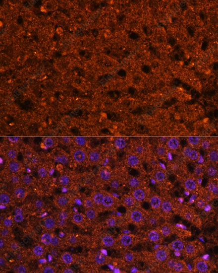 Иммунофлуоресценция, HMGCS2, ткань печени крысы