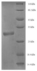 SDS-PAGE