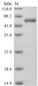SDS-PAGE
