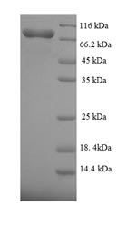 SDS-PAGE