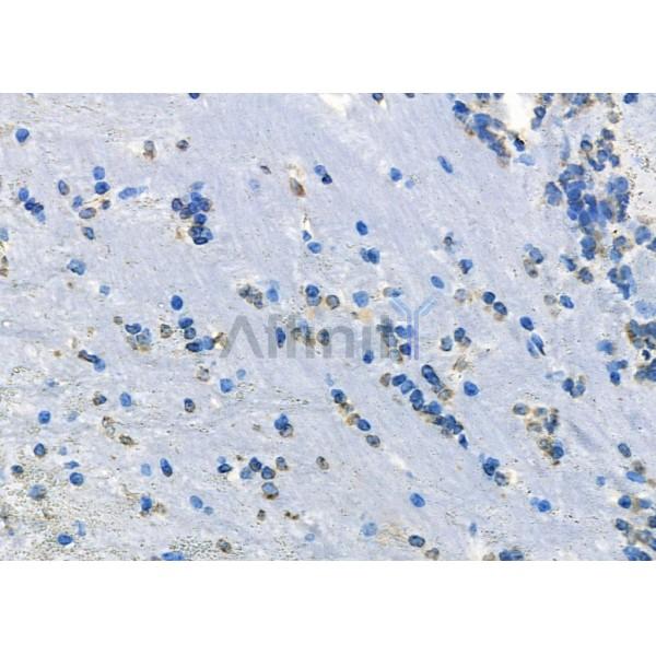 Валидация Affinity DF8926 - 21068