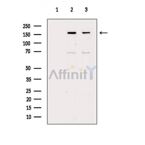 Валидация Affinity AF6291 - 3554