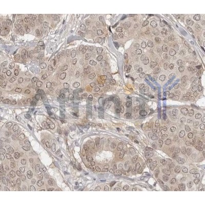 Валидация Affinity AF5118 - 2483