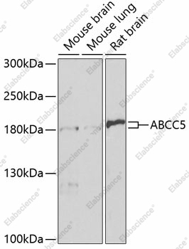 Вестерн-блоттинг, ABCC5, различные клеточные линии