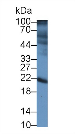 14140
