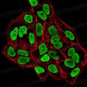Валидация IF - AntibodySystem RHJ72201