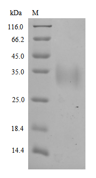 SDS-PAGE