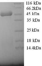 SDS-PAGE