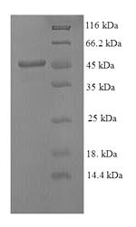 SDS-PAGE