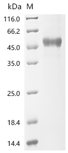 SDS-PAGE