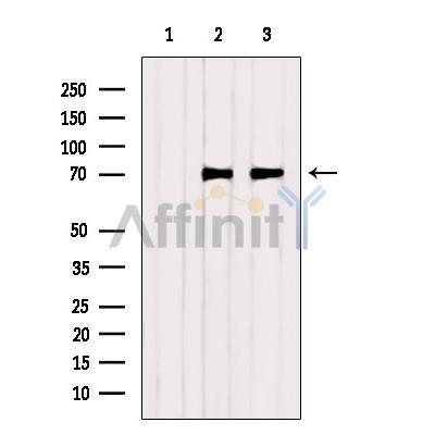 Валидация Affinity AF6412 - 3706