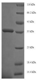 SDS-PAGE