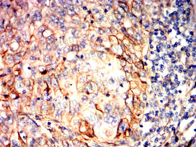 Валидация AntibodySystem RHK08804 (3620)