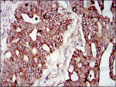 Валидация AntibodySystem RHD75803