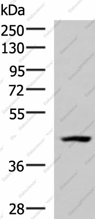Вестерн-блоттинг, MAGEC2, клетки 293T