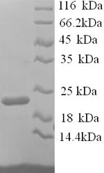 SDS-PAGE