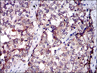 Валидация AntibodySystem RHC17301