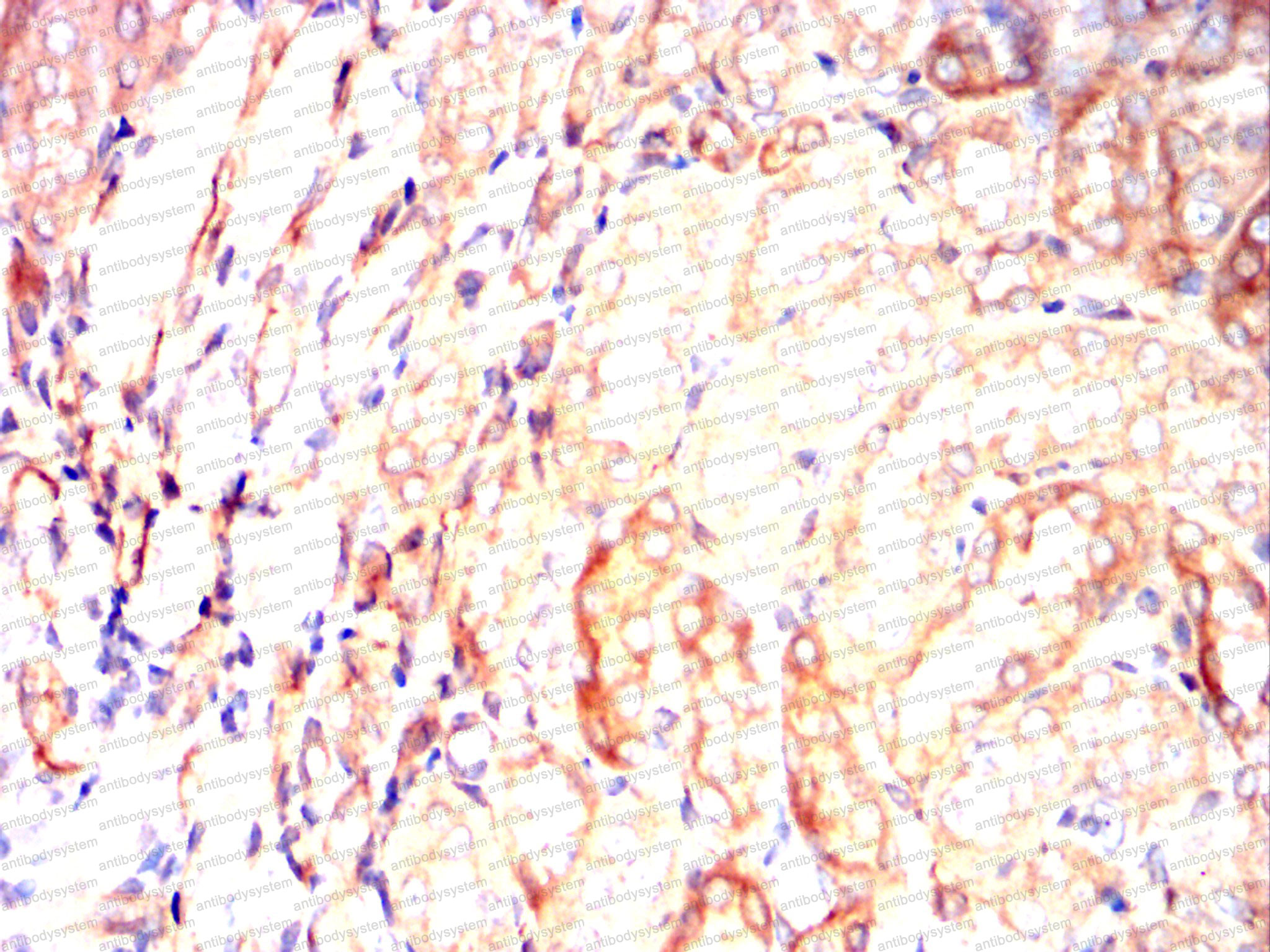 Валидация AntibodySystem RHC13909 (666)