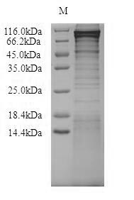 SDS-PAGE
