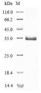 SDS-PAGE