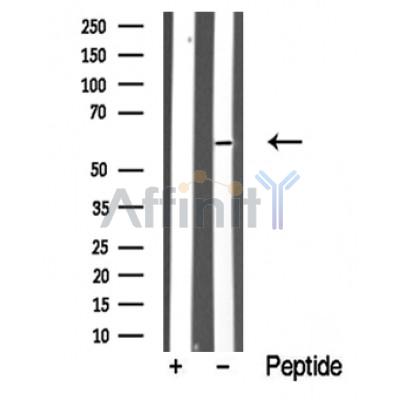 Валидация Affinity DF10361 - 5985