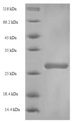 SDS-PAGE