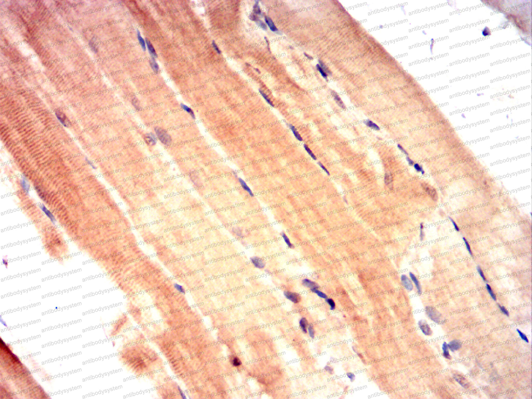 Валидация AntibodySystem RHH38602 (3293)