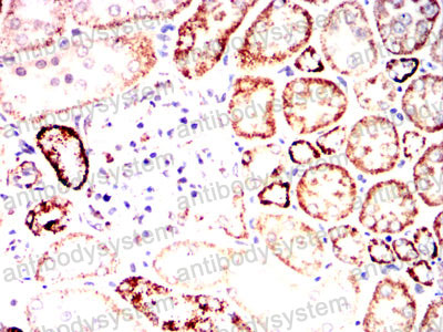 Валидация AntibodySystem RHC33504