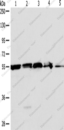 Вестерн-блоттинг, NAMPT, клетки A375, 293T, Jurkat, ткань печени мыши и ткань почки плода человека