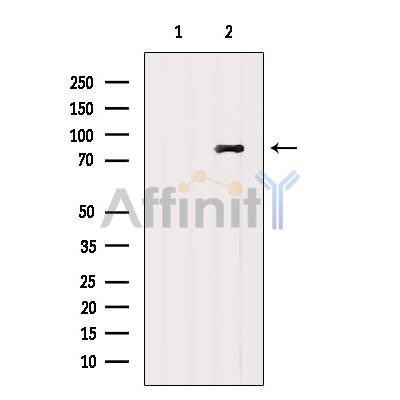 Валидация Affinity DF6287 - 17598