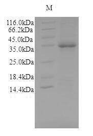 SDS-PAGE