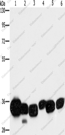 Вестерн-блоттинг, CBR1, ткань печени мыши, ткань плода человека, клетки HeLa, ткань почки мыши, ткань глиомы человека, клетки K562