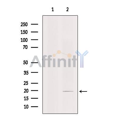 Валидация Affinity AF4112 - 2165