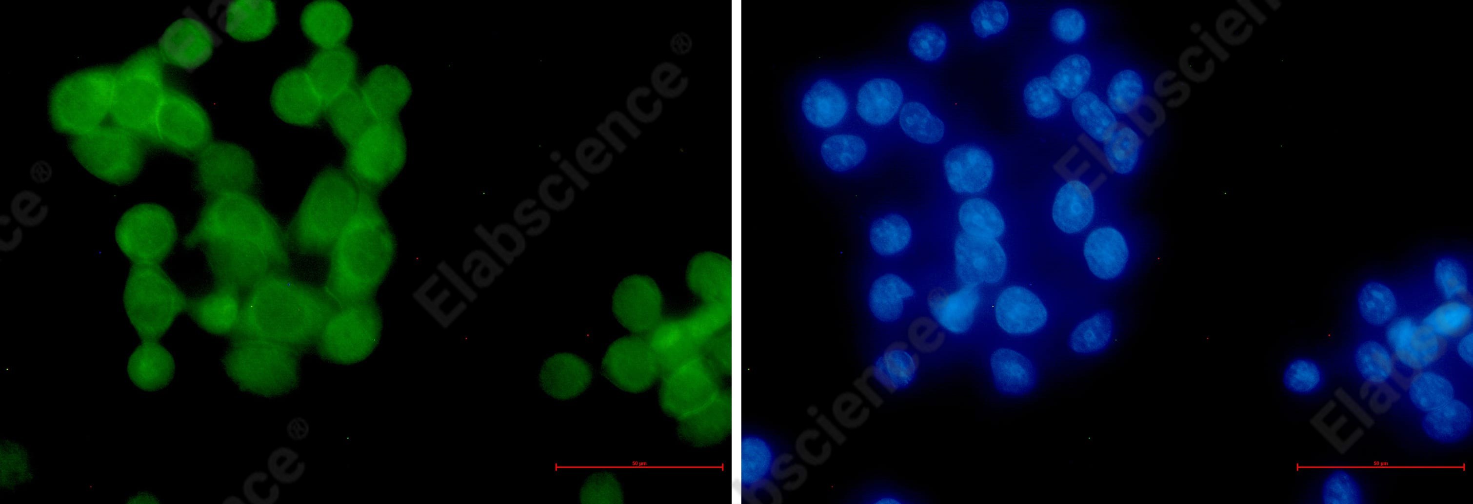 Иммунофлуоресценция, Ubiquitin (K63), клетки HeLa