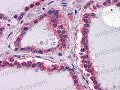 Валидация AntibodySystem RHC28601 (850)