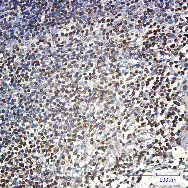 Валидация AntibodySystem RHC19202