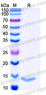 YHJ39302, SDS-PAGE