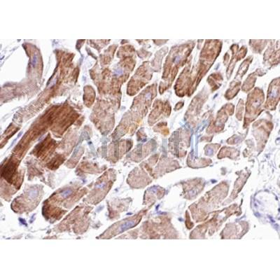 Валидация Affinity AF4201 - 2174