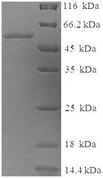 SDS-PAGE