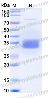 EHC26701, SDS-PAGE