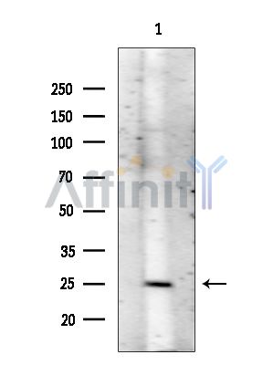Валидация Affinity AF5104 - 2457