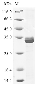 SDS-PAGE